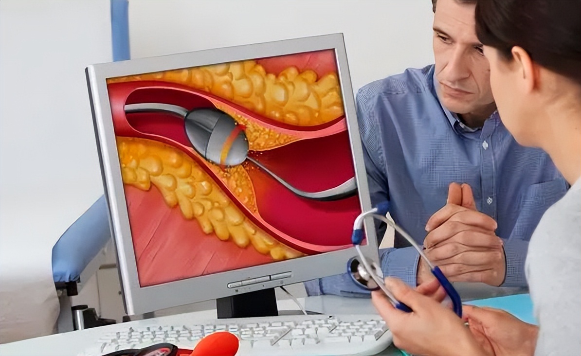 介入治疗后发烧怎么解决,做介入后发烧多久是正常的