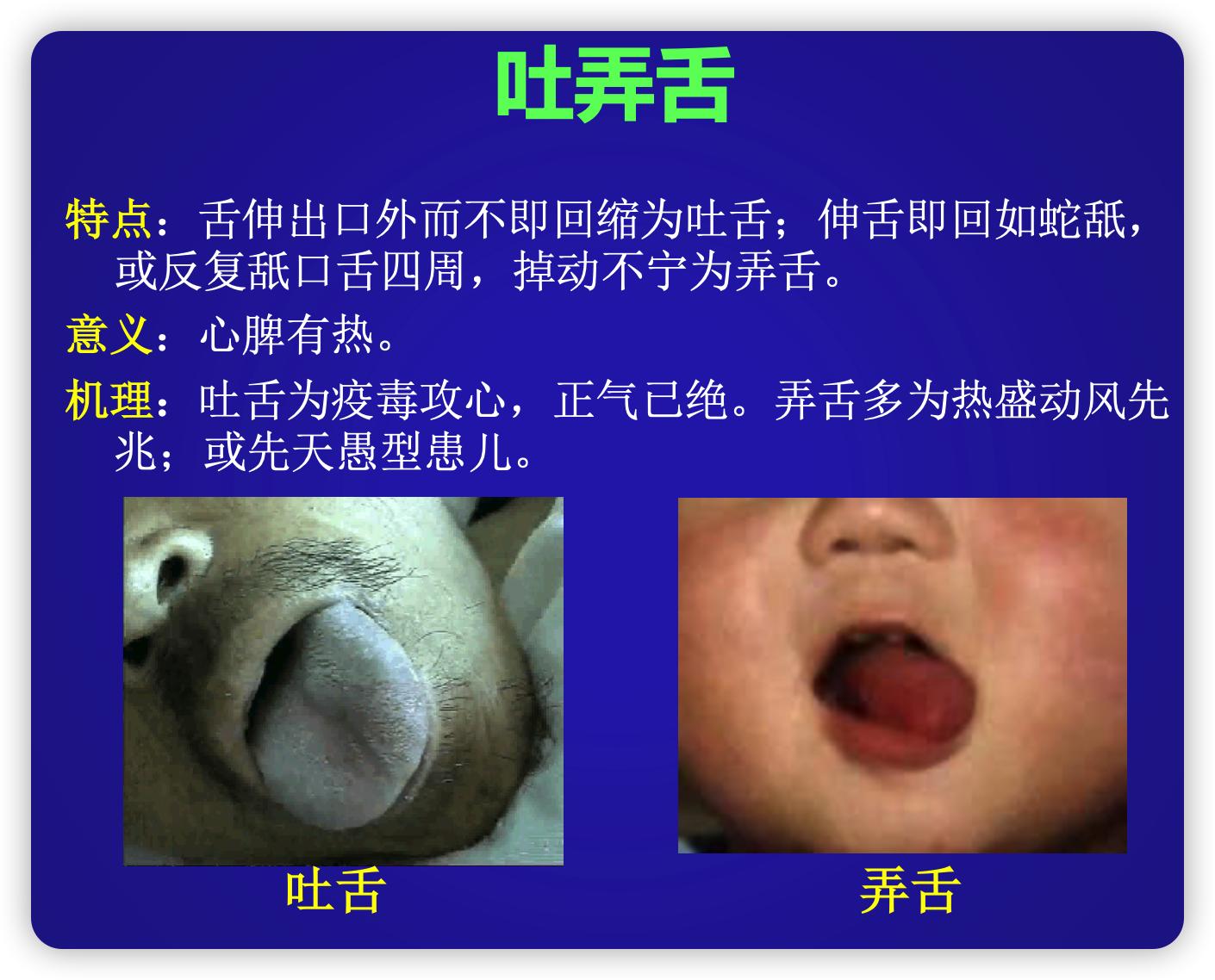舌诊不难:解读颤动舌、吐弄舌和短缩舌