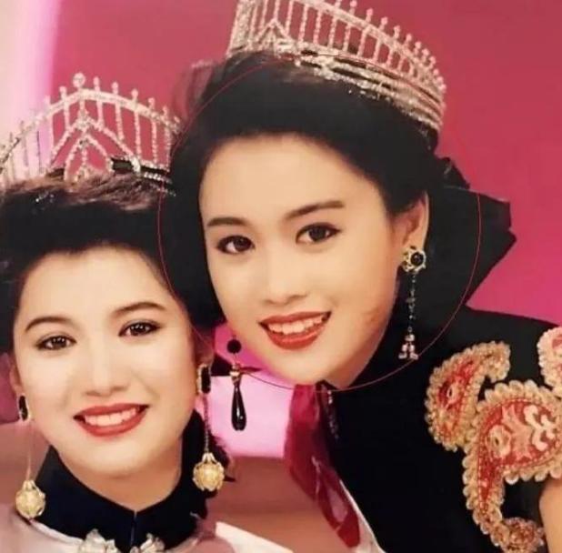 高鼻梁塌却很漂亮的女星,凸嘴短下巴的女人面相