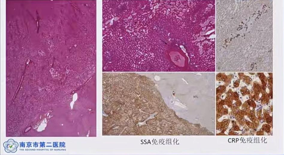 肝囊肿和肝占位影像学鉴别,杨永峰医生个人简历