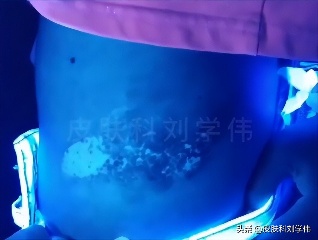 女孩身体里藏着一只12米长的怪虫,女孩体内长虫