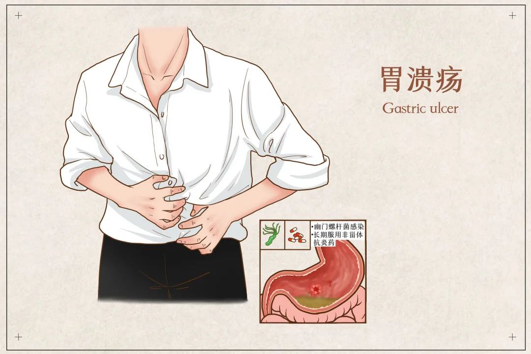 打嗝烧心反酸食道灼热怎么缓解,总是烧心有什么小偏方