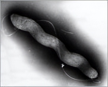 由致病菌引起的食物中毒常见症状,夏季食源性疾病高发