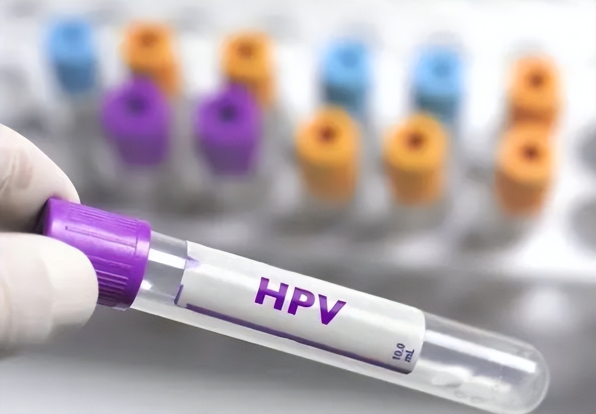 月经出现这4种异常,月经出现问题需要做哪些检查