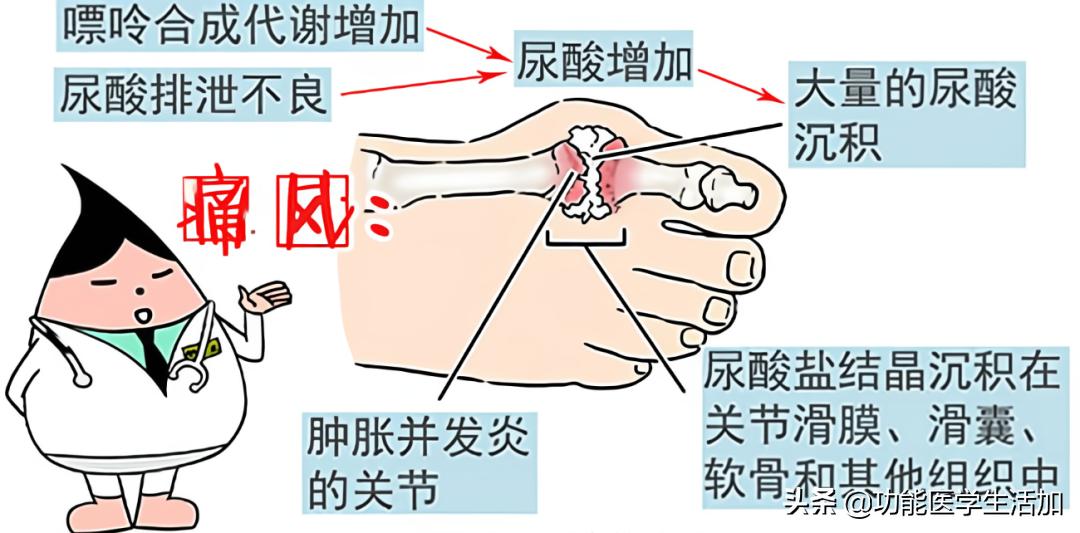 尿酸高怎么拒绝喝酒,尿酸高吃什么药可降尿酸不伤肝