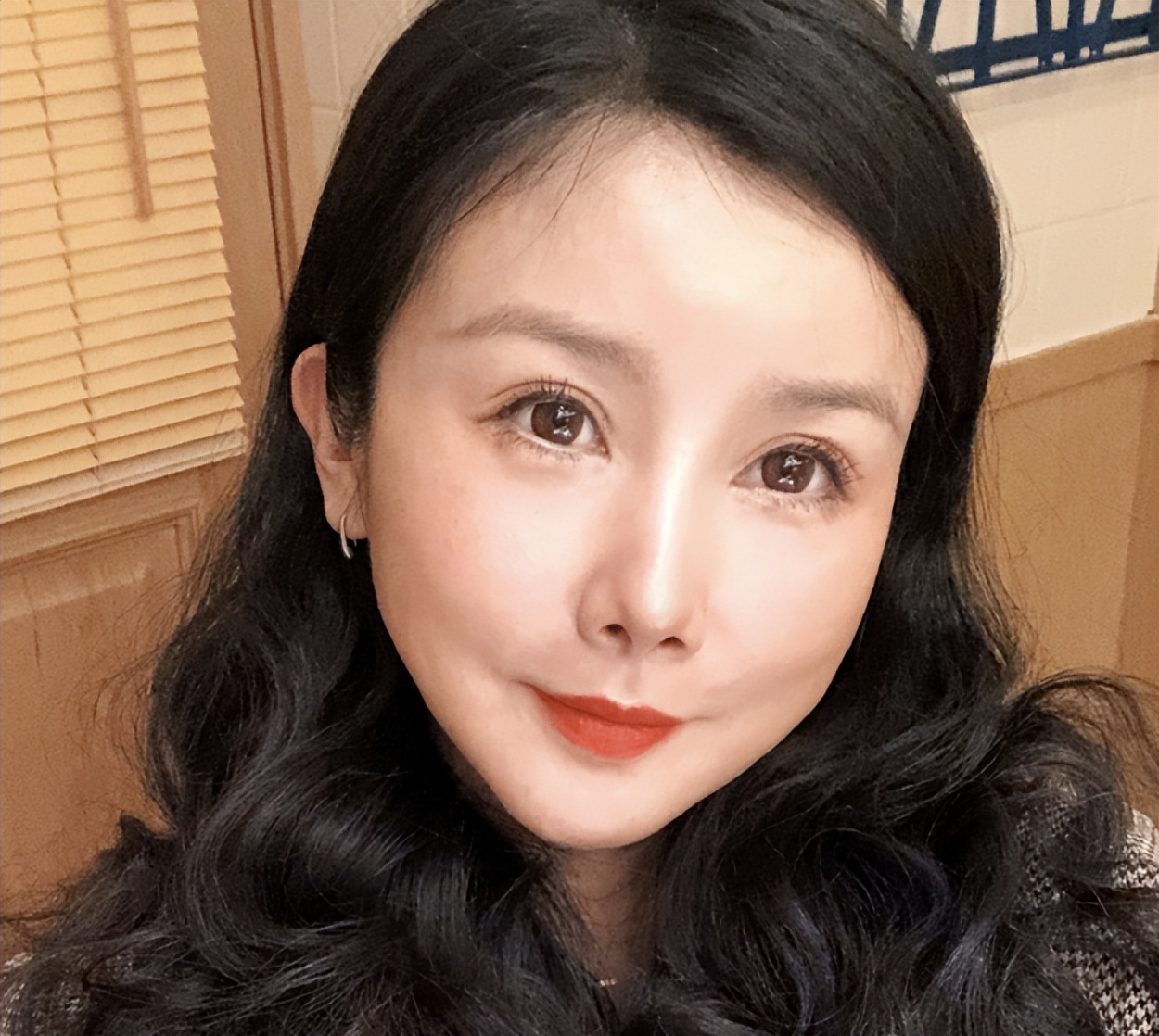 明星下颚骨整容后遗症,脸像鞋拔子怎么改善