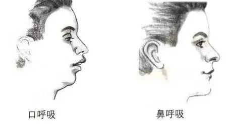 为什么越长越丑怎么改变,越变越丑是什么原因