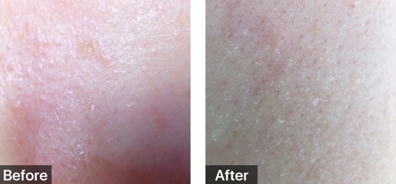 <html>
<head><title>502BadGateway</title></head>
<body>
<center><h1>502BadGateway</h1></center>
<hr><center>nginx</center>
</body>
</html>
<!--apaddingtodisableMSIEandChromefriendlyerrorpage-->
<!--apaddingtodisableMSIEandChromefriendlyerrorpage-->
<!--apaddingtodisableMSIEandChromefriendlyerrorpage-->
<!--apaddingtodisableMSIEandChromefriendlyerrorpage-->
<!--apaddingtodisableMSIEandChromefriendlyerrorpage-->
<!--apaddingtodisableMSIEandChromefriendlyerrorpage-->
