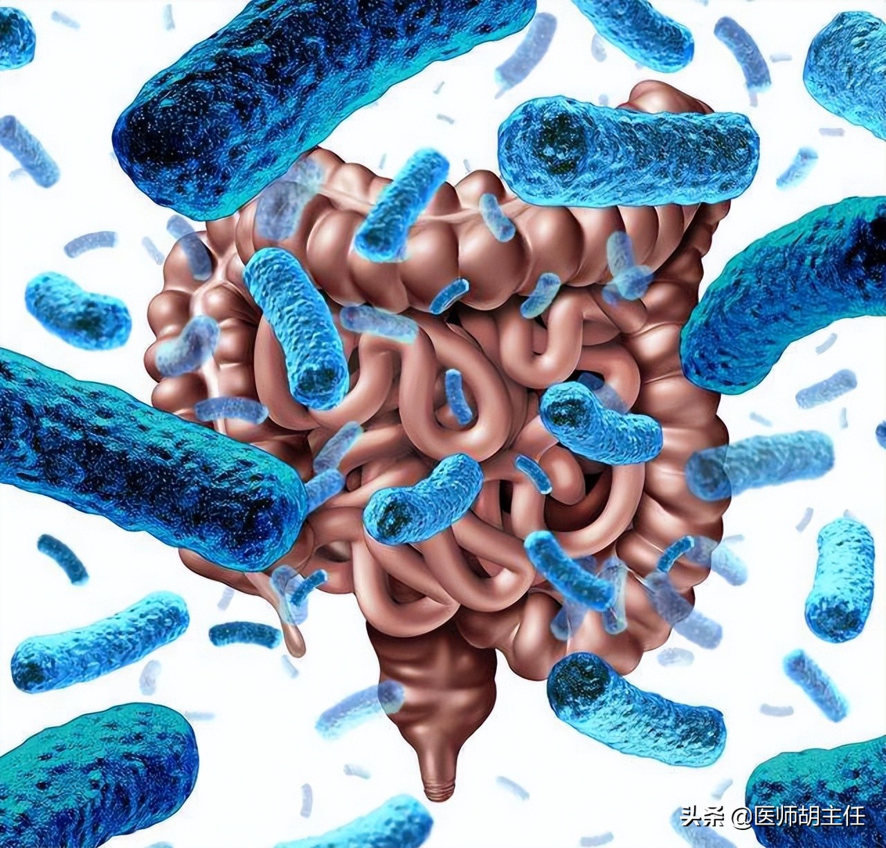 如果肠道长息肉身体会有哪些反应,肠道长息肉会有什么症状