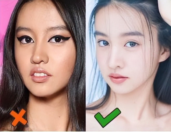 轻微嘴凸法令纹真的让人很自卑,法令纹严重是因为嘴凸吗