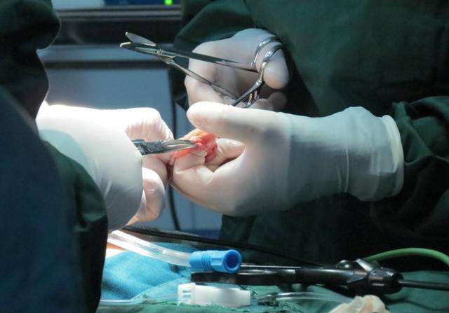 手术时，医生切开的伤口怎么不流血？说出真相