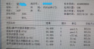 甲亢脚发软可以吃钙片吗,甲亢吃药还可以吃钙片吗