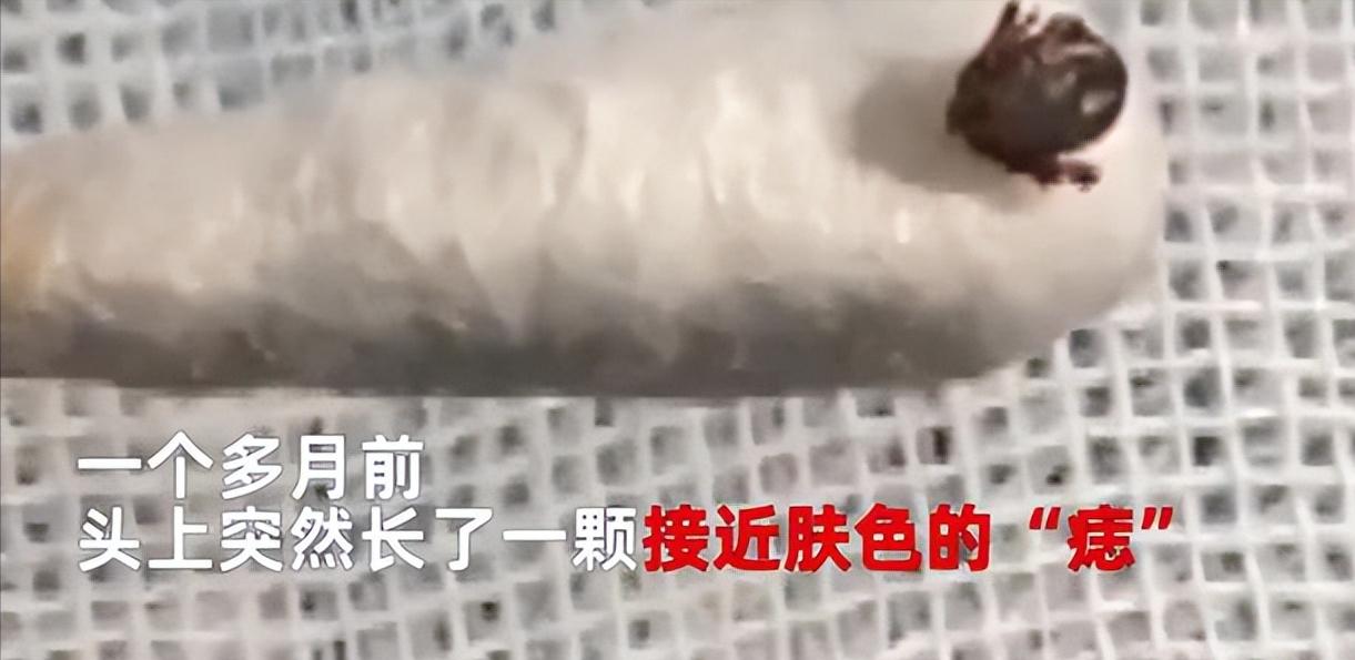 湖南一女孩被女蜱虫咬,女童野外游玩被蜱虫叮咬