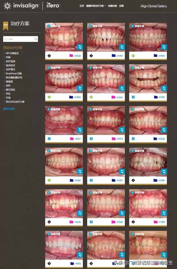 隐适美矫正和普通矫正的区别,隐适美矫正有几种版本