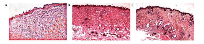 积雪草跟油橄榄哪个消炎效果好 (油橄榄和积雪草哪个适合油皮)