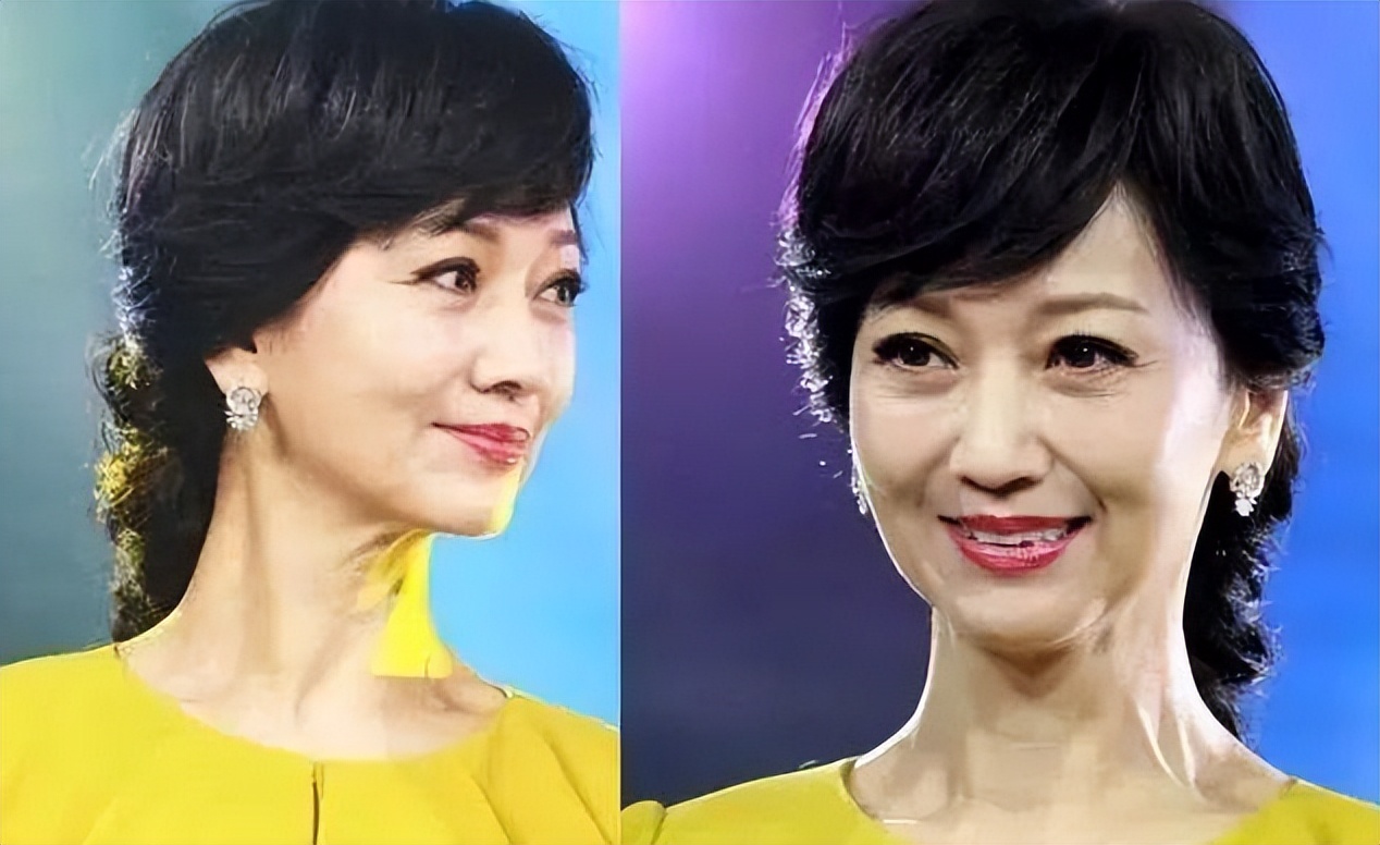 面部衰老皱纹解剖图,面部皱纹衰老对比图