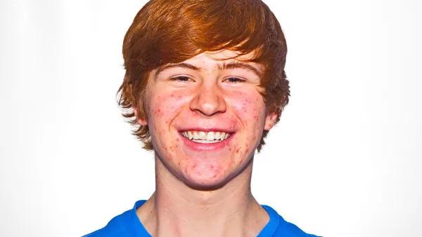 痘痘怎么快速消红消肿,结节性痘痘怎么消下去