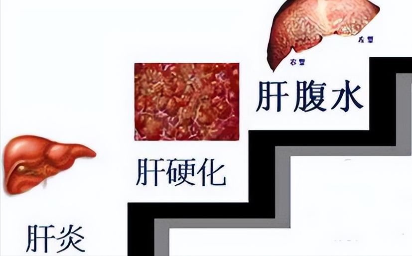 男孩治愈了，妈妈还是大三阳。一样的病毒，不一样的免疫反应