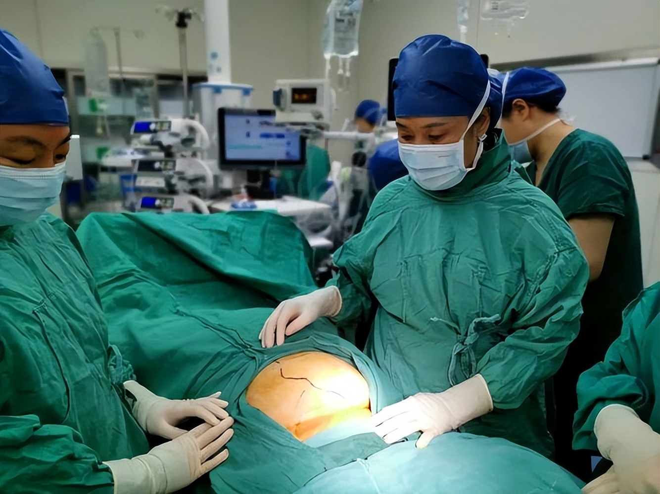 【科普】子宫内膜癌有两种类型，你了解吗？腹腔镜手术效果如何？