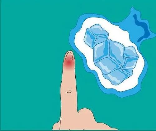 桡骨狭窄性腱鞘炎热敷还是冰敷,中指腱鞘炎是热敷还是冰敷