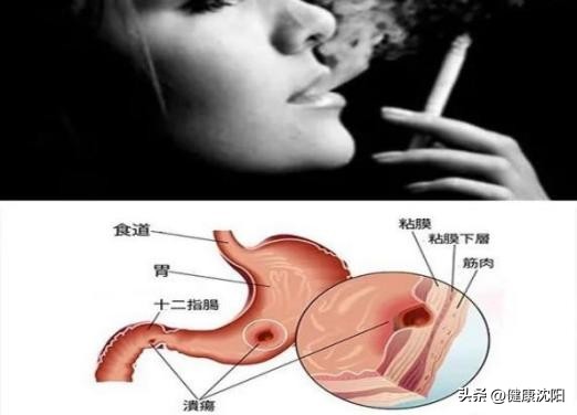 世界无烟日吸烟对身体的十大危害,世界无烟日烟的危害不容小视