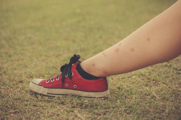 为什么一群人中蚊子偏偏咬你,一群人里面蚊子为什么只爱咬一人