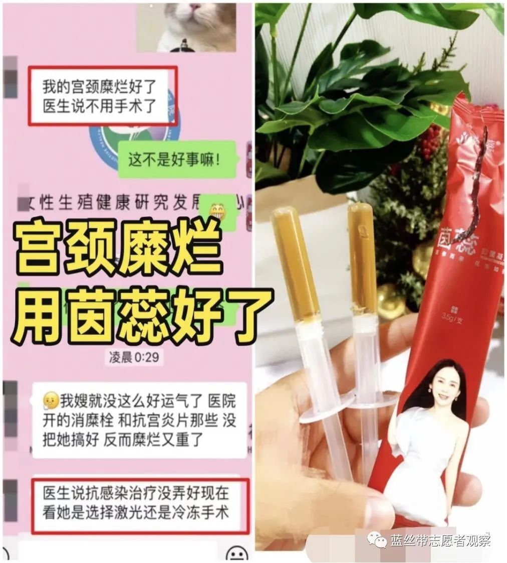 茵蕊抑菌妇科凝胶是正规品牌吗,茵蕊抑菌凝胶是正规产品吗