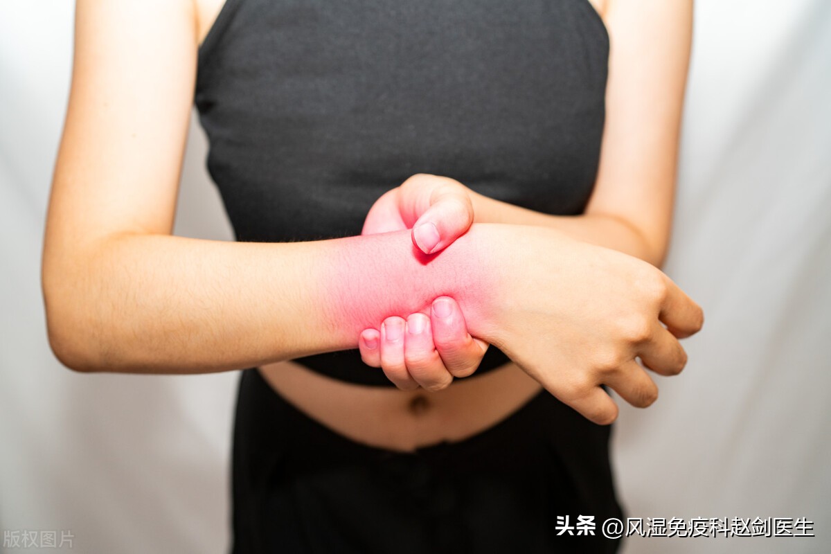 敲键盘手腕酸疼,敲键盘手腕肿痛