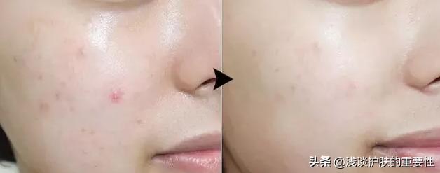 护肤品是否温和，选择适合自己的方法有哪些？