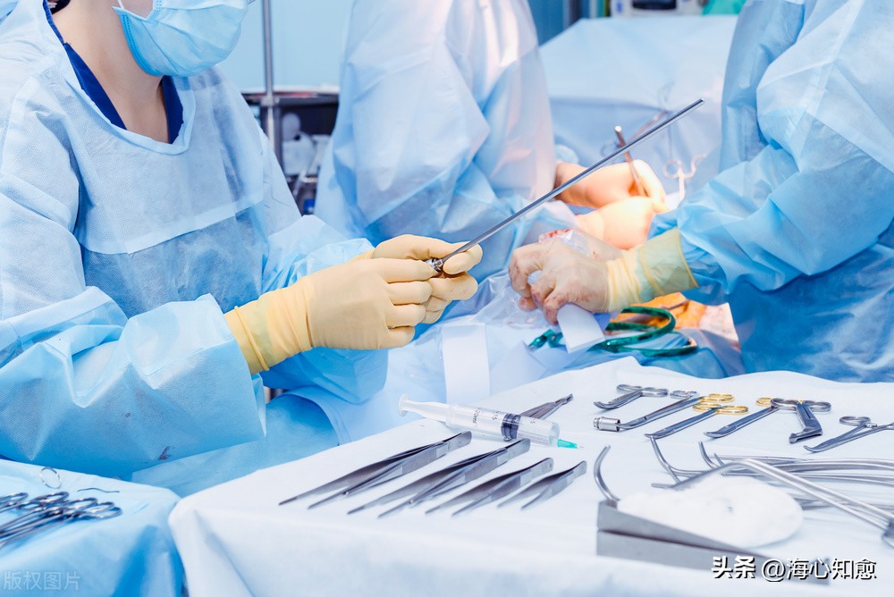 肠癌晚期做小肠造口能治好吗,肠癌预防性造口