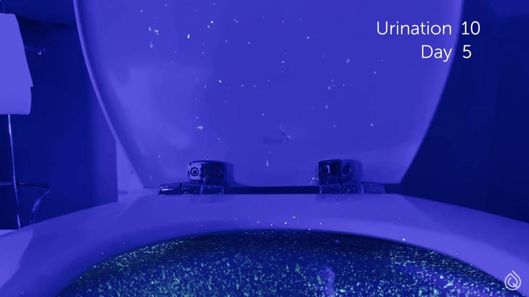 被公厕便池的水溅到,会得性病吗?|8个如厕烦恼全解