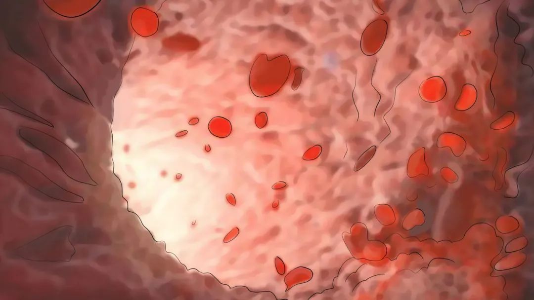 体检尿隐血一定是膀胱炎吗,体检结果尿隐血是怎么回事