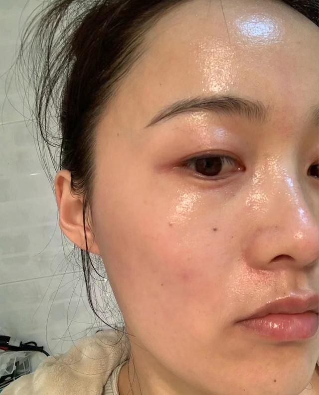 为什么涂完护肤品非常黏腻,护肤品吸收了好还是有粘腻感好