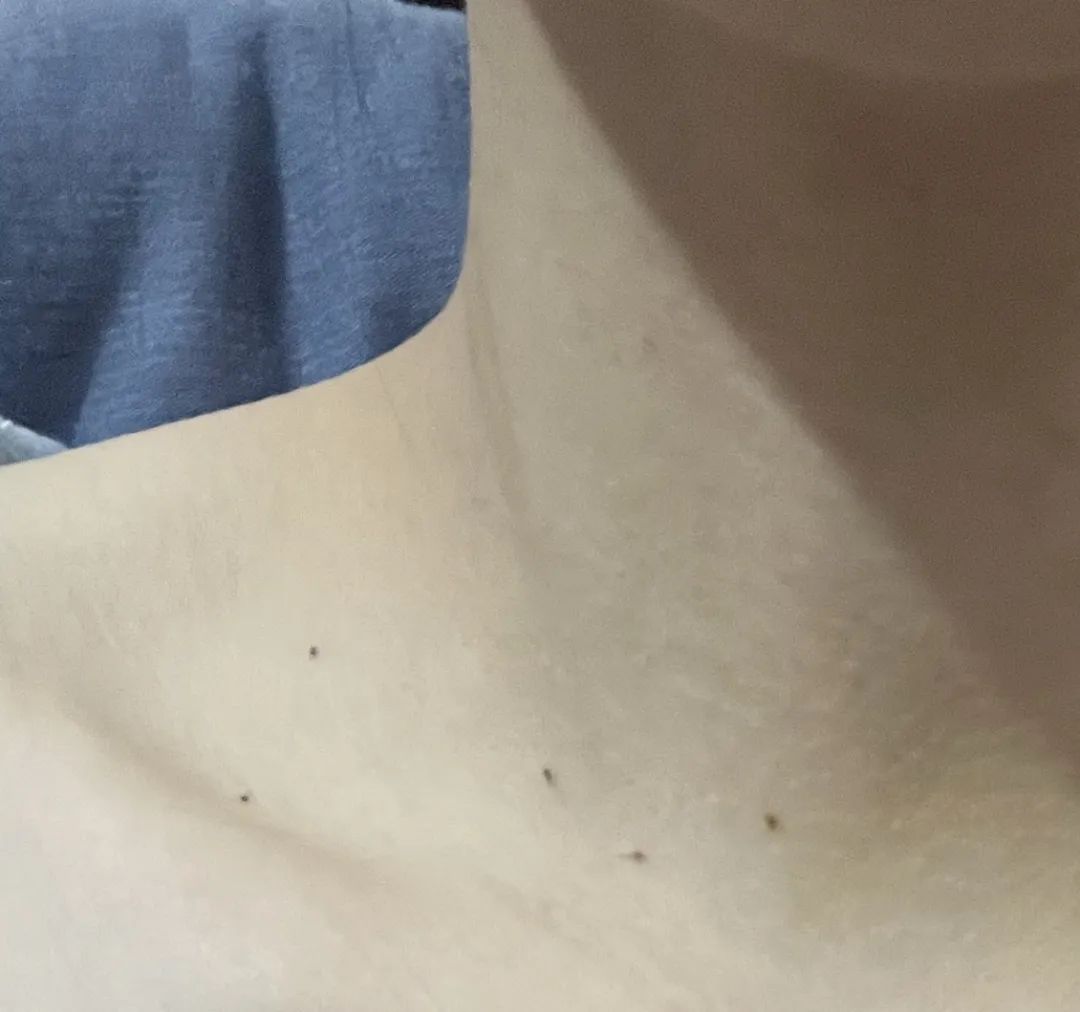 夏天防中暑特效药有卖吗,夏季酷暑防中暑的药