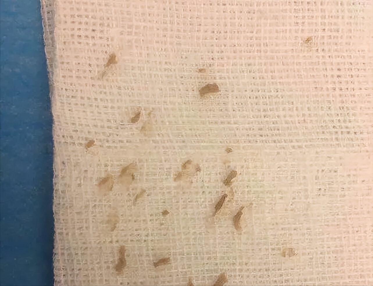 鼻子黑头感觉脏脏的,草莓黑头怎么去除最有效