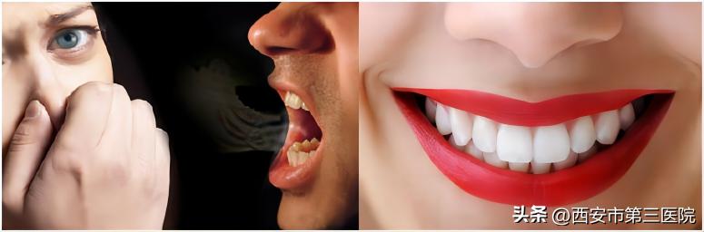 口臭咽喉不适,口臭口腔莫名不舒服还有点苦