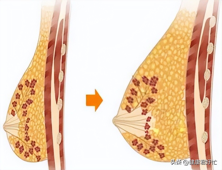 有哪些乳腺知识一定要了解,女生乳腺冷知识