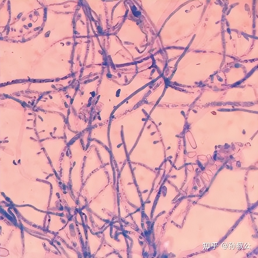 艾草能泡脚治疗脚气吗,碳酸氢钠泡脚能治疗脚气吗