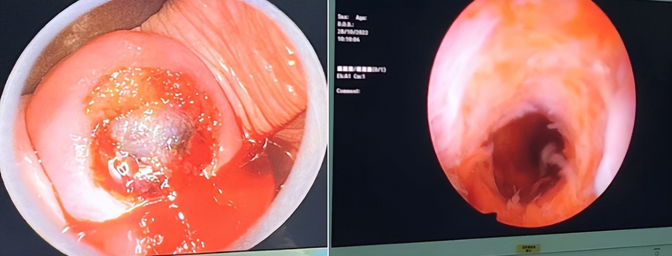 沈阳红十字会医院妇科医生,沈阳红十字会医院妇产科