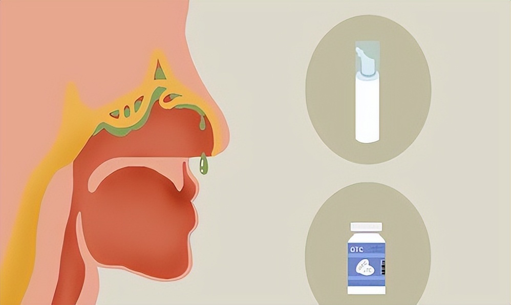 鼻分泌物中客观标志物，在不同鼻炎中的，临床应用。