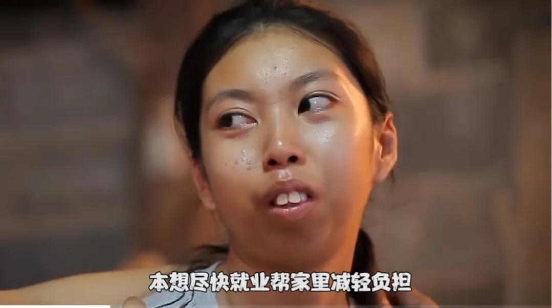 这才是整容存在的意义泰国美女天生没有下巴，整容后迎来全新人生