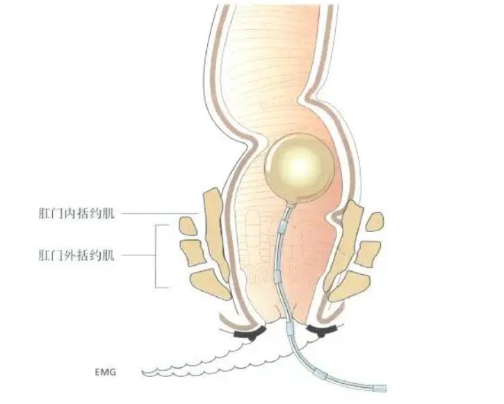医生给患者做直肠检查,医生给病人做直肠肛检插管