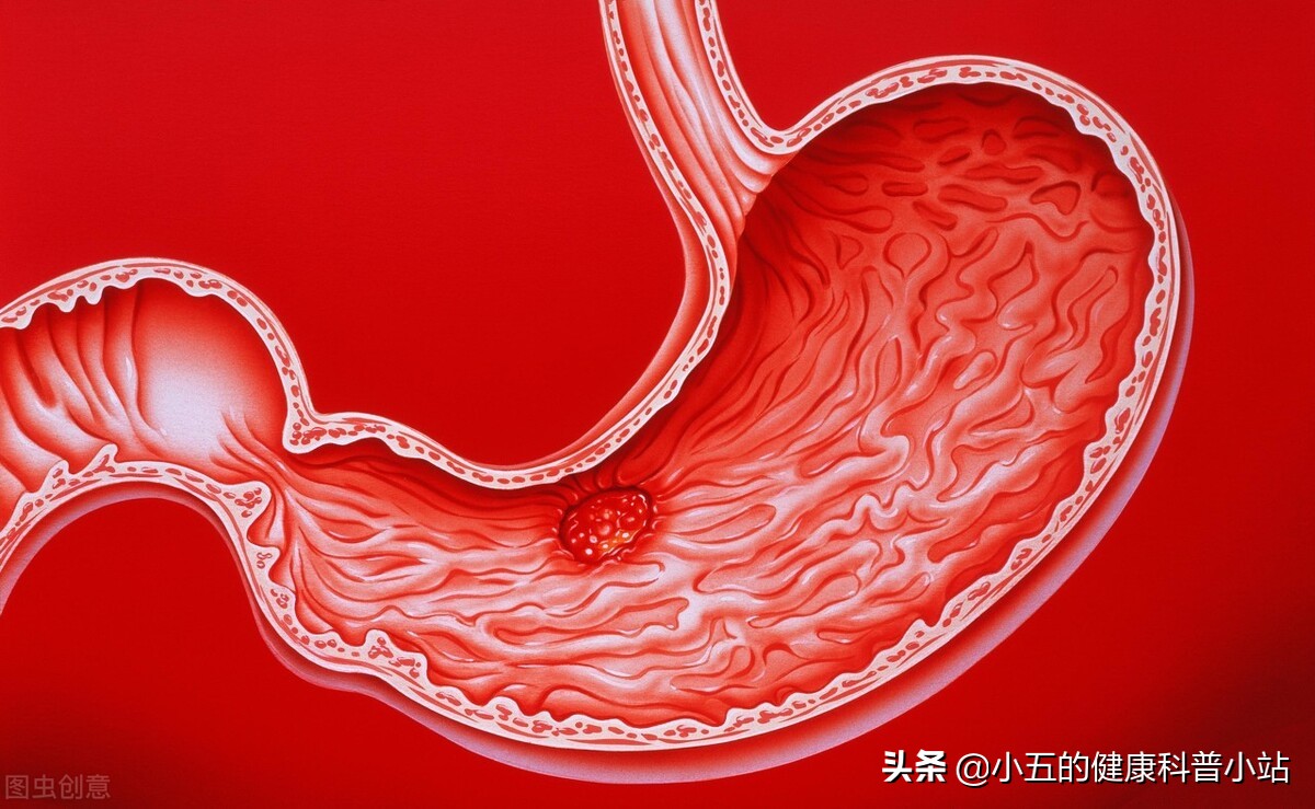 喝酒突然吐血紧急抢救,吃饭时无缘无故吐血