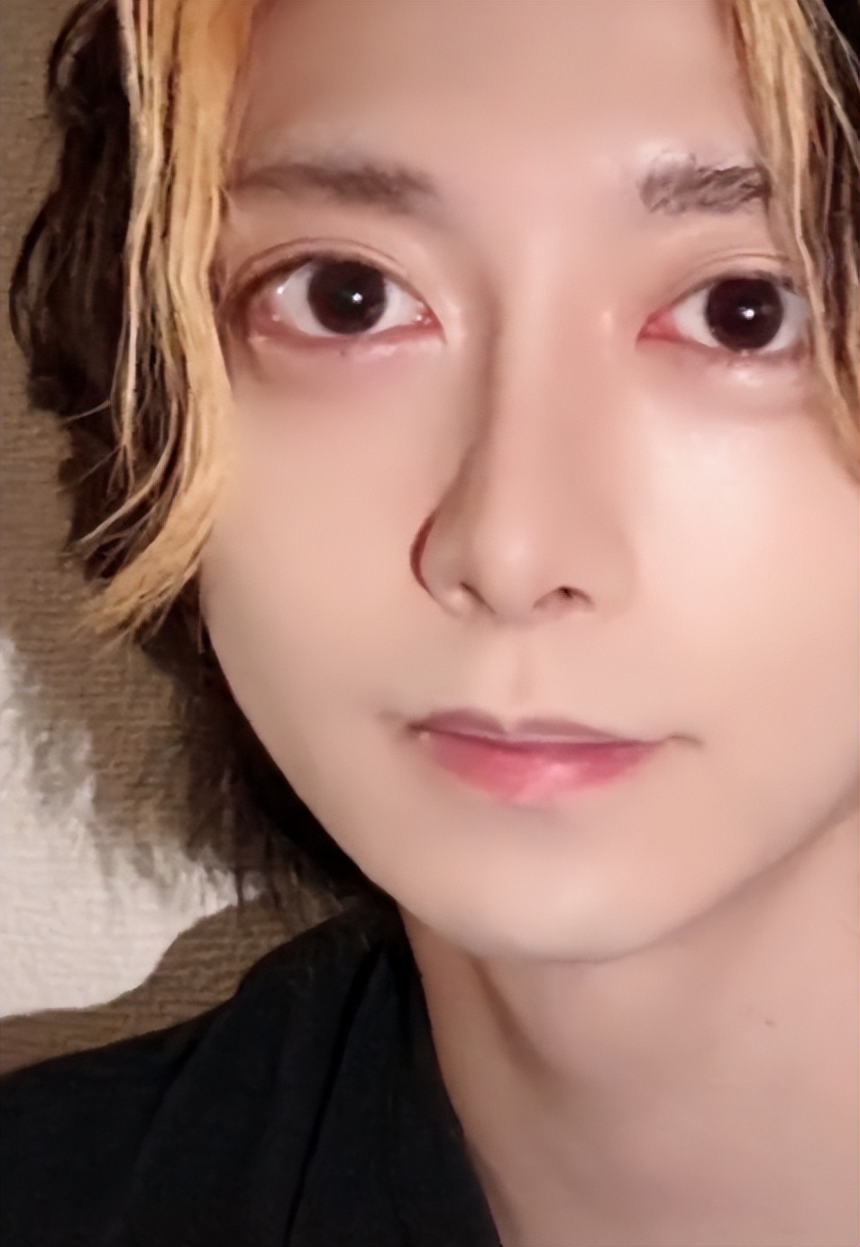 日本1米5小哥砸1600万疯狂整容增高！断骨惨烈过程吓傻网友