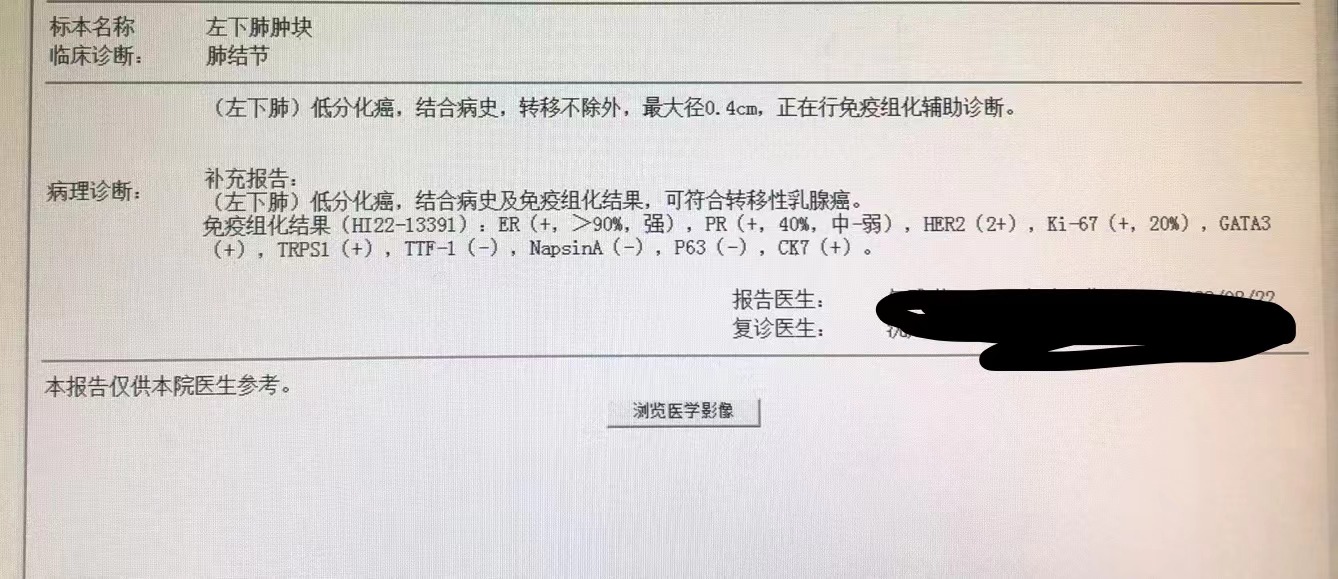 激素受体阳性晚期乳腺癌化疗方案,孕激素受体对乳腺癌内分泌治疗