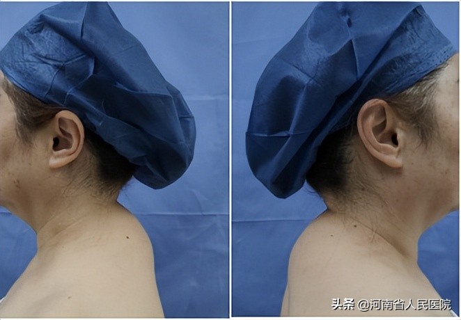 一小时，让她卸下背了十余年的“包袱”