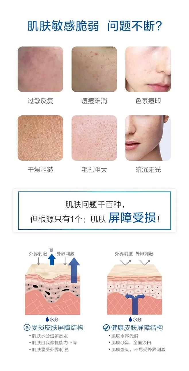 敏感肌肤脸红用哪款护肤品,敏感肌肤到夏天脸红怎么办