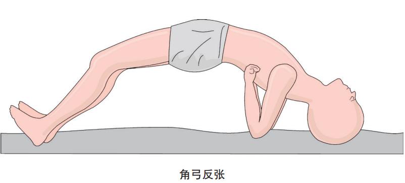 预防破伤风感染最有效的方法,别大意破伤风预防的这几点误区