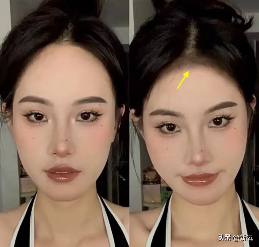 发际线高低怎么样才合适,发际线高低有没有影响运气