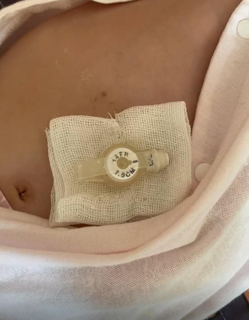 一针70万的救命药后续,70万一针的救命药能救什么